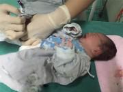 Bà bầu - Thai nhi 7 tháng giảm chuyển động, bác sĩ choáng váng khi mổ cấp cứu lấy thai