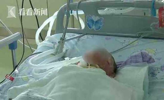 Mẹ mải buôn chuyện với bạn không để ý, con đùa nghịch lao đầu vào nồi lẩu sôi sùng sục - 1