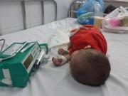 Tin tức - Bé trai 20 tháng chỉ nặng 6kg sống lay lắt qua ngày vì mắc căn bệnh ai nghe cũng sợ