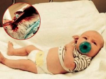 Đưa con sơ sinh đi cắt bao quy đầu, mẹ bàng hoàng khi thấy máu chảy không ngừng