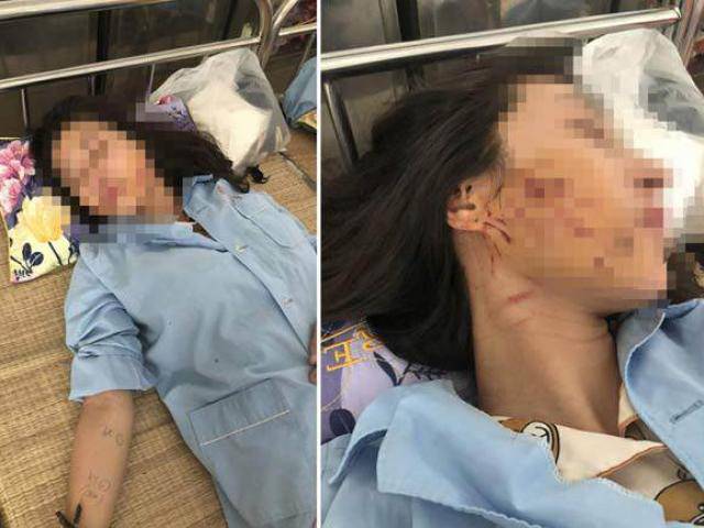 Vụ đánh ghen ở Thanh Hóa: Kiều nữ bị đổ nước mắm, bột ớt lên tiếng