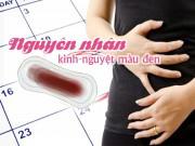 Sức khỏe - Nguyên nhân khiến kinh nguyệt màu đen là gì?