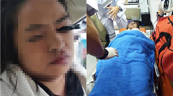 Tai nạn khiến chị em giật mình: Trang điểm trên taxi, cô gái bị chì kẻ mày đâm xuyên mắt - 1