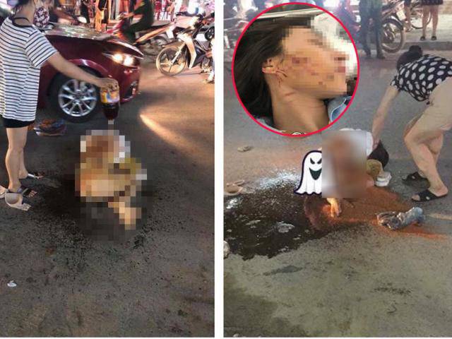 Cô gái bị đổ nước mắm, muối ớt lên người ở Thanh Hóa đề nghị khởi tố vụ án