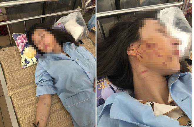 Tin tức 24h: Quan hệ lén lút, nữ chủ nhà trọ bị amp;#34;dính chặtamp;#34; với người tình trong khách sạn - 3