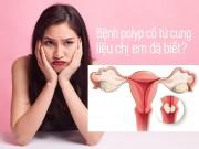 Sức khỏe - Polyp cổ tử cung - chị em nhất định phải biết