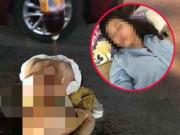 Tin tức - Vụ đánh ghen ở Thanh Hóa: Triệu tập 4 người hành hung, đổ nước mắm lên người cô gái trẻ