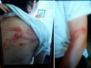 Tin tức - Bố đẻ dùng dây lưng đánh 2 con ứa máu dù đó là ngày Quốc tế Thiếu nhi