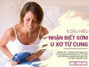 Sức khỏe - Thấy 6 dấu hiệu này lập tức đi khám ngay, biết đâu u xơ tử cung đã "tìm" đến bạn