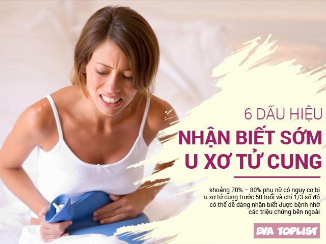 Thấy 6 dấu hiệu này lập tức đi khám ngay, biết đâu u xơ tử cung đã tìm đến bạn