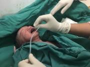 Bà bầu - Con nặng 3,6kg vừa lọt lòng đã phải cấp cứu vì lỗi tai hại của mẹ khi mang bầu