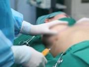 Sức khỏe - Cứ ngỡ u vú, đến khi phẫu thuật bác sĩ "phát hoảng" khi lấy ra thứ đáng sợ gấp bội