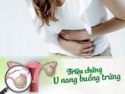 Sức khỏe - Triệu chứng u nang buồng trứng chị em nhất định phải ghi nhớ