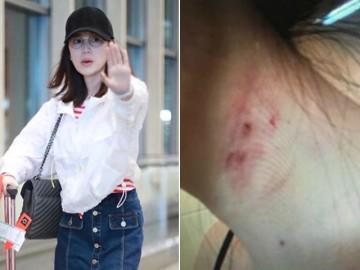 Tình tiết mới vụ ly hôn của Ảnh đế Cbiz: Vợ tung bằng chứng bị chồng đánh đập