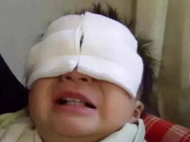 Món đồ chơi nhiều trẻ em Việt thích khiến bé trai 9 tuổi bị thủng mắt