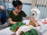 Tin tức - Thắt lòng bé trai 5 tháng tuổi bị hoại tử ruột phải cắt gần hết sau bữa ăn đầu đời