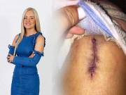 Làm đẹp - Chỉ vì lười bôi kem chống nắng, cô nàng này suýt nữa phải trả giá bằng tính mạng của mình