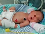 Bà bầu - Tưởng mẹ bầu vỡ ối bình thường, bác sĩ khám xong hốt hoảng mổ đẻ ngay trong 9 phút