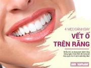 Đẹp - Cầm 10.000 chạy ngay ra chợ mua những vật dụng này để có hàm răng trắng không tỳ vết