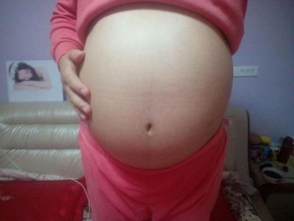 Mang thai 42 tuần mẹ chồng không cho đẻ mổ, đến lúc em bé chào đời ai cũng xót xa - 1