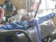 Sức khỏe - Tưởng chỉ là đau răng, 3 ngày sau người đàn ông phải nhập viện vì bệnh nguy hiểm gấp đôi