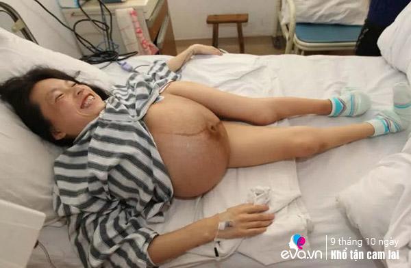 Mẹ tí hon 110cm vô tư ân ái với chồng 1m7, tử cung bé xíu dính bầu liên tục - 7