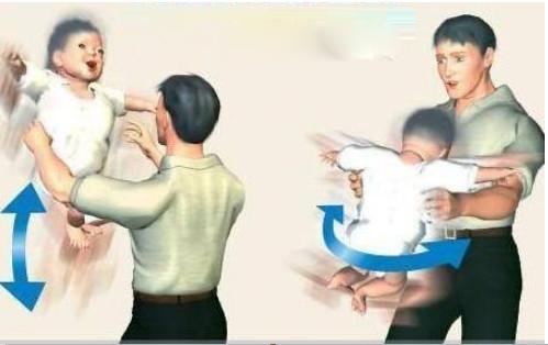 Bé 4 tháng bị tràn dịch não vì cách chăm sóc sai lầm nhiều mẹ Việt hay mắc - 4