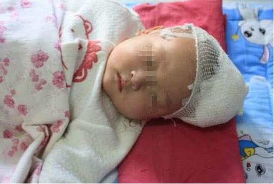 Bé 4 tháng bị tràn dịch não vì cách chăm sóc sai lầm nhiều mẹ Việt hay mắc - 2