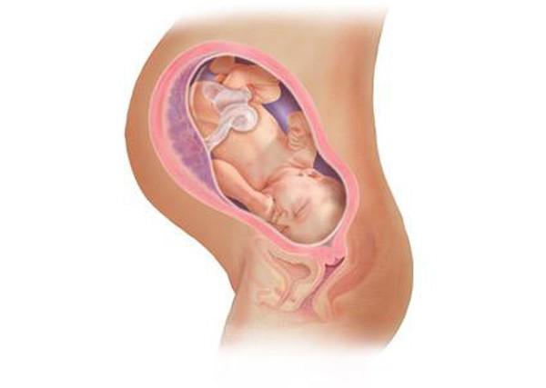 Cảnh báo từ chuyên gia: Băng huyết sau sinh, tai biến sản khoa  hàng đầu dẫn đến tử vong - 3
