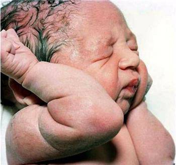 Gái quê dự sinh quá 14 ngày tử cung vẫn đóng, bác sĩ mổ bụng choáng vì mùi hôi nồng - 3