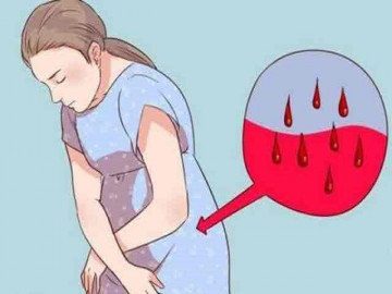 Sản dịch sau sinh và những vấn đề mẹ cần biết theo lời khuyên của bác sĩ