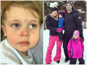 Làm mẹ - Bị viêm amidan, bé trai bỗng thích tự làm hại mình