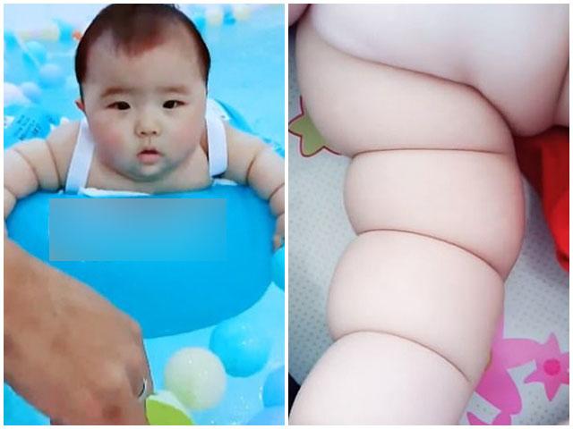 Tay chân chắc nịch từng múi thịt, bé gái 6 tháng có cân nặng bằng trẻ 30 tháng