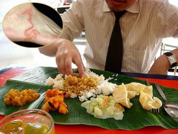 Không chỉ ăn uống, những thói quen không ngờ này có thể khiến ký sinh trùng xâm nhập cơ thể