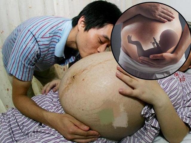Chồng nghe thấy bụng vợ bầu phát tiếng cười em bé, bác sĩ sợ hãi Thai nhi đang nguy kịch