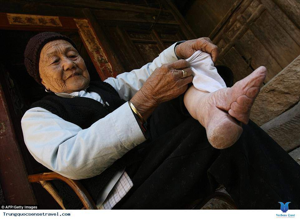 Đeo đĩa vào môi và những tập tục làm đẹp kỳ dị của phụ nữ trên khắp hành tinh - 16