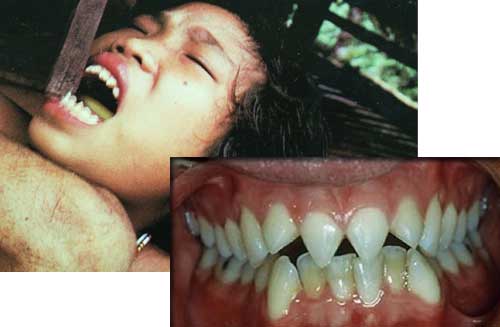 Đeo đĩa vào môi và những tập tục làm đẹp kỳ dị của phụ nữ trên khắp hành tinh - 19