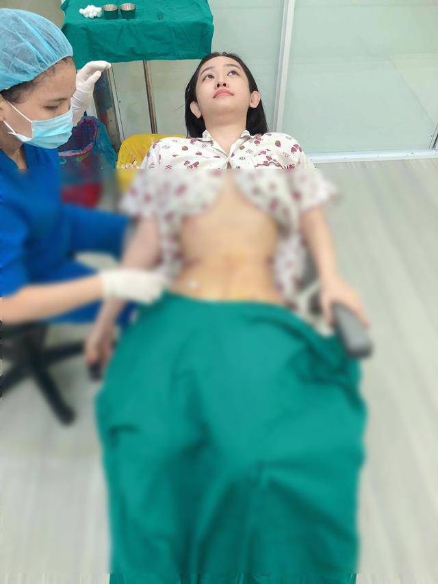 Đã hút 2kg mỡ thừa, Thúy Vi vẫn bị CĐM phát hiện dùng app chỉnh eo... lệch cả rốn - 8