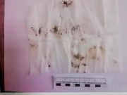 Sức khỏe - Bé gái bị viêm "vùng kín" nặng, rách màng trinh nghi bị người thân xâm hại nhưng sự thật là...