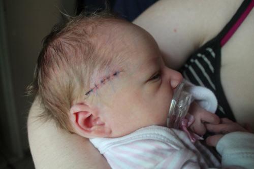 Xót xa những em bé sơ sinh bị bác sĩ mổ đẻ trúng người - 6