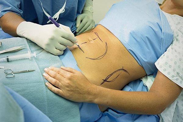 Cô gái trẻ thiệt mạng sau khi đến bệnh viện tư làm thủ thuật hút mỡ bụng - 1