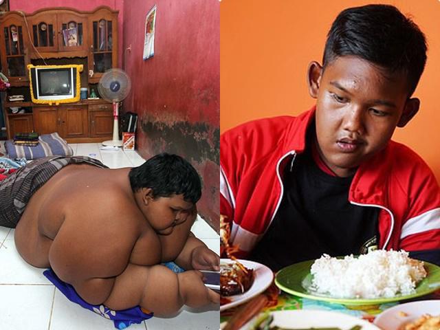 Bé trai nặng 190kg đổi đời khi giảm 104kg nhưng thân hình hiện tại vẫn gây sốc