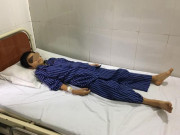 Sức khỏe - Từ vụ 2 anh em bị tan máu nguy kịch khi ăn xôi, lưu ý điều này khi nấu ăn?