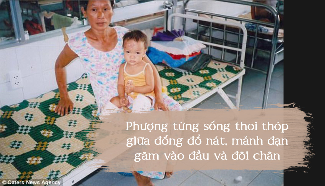 Bé gái Việt bị cha đẻ gài mìn, 14 năm sau ai cũng phải nể phục - 7