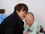 Bà bầu - Hai vợ chồng cùng khuyết tật vẫn ngọt ngào làm “chuyện ấy”, đẻ con ra ôm mặt khóc nức nở