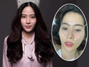 Giải trí - Nhập viện lúc 1 giờ sáng, Nam Em vẫn còn sức lên mạng kêu gọi mọi người... thương mình