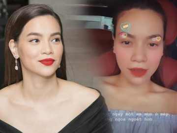 Nắng Sài Gòn đáng sợ quá, đến Hà Hồ cũng bị nổi mụn, lại ngay chỗ ngoa ngoắt hết sức