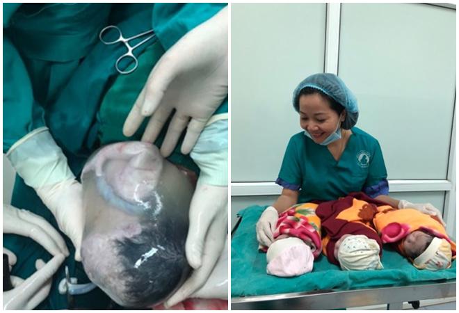 Mẹ Hưng Yên mang thai 4, sinh 3 khiến các bác sĩ trầm trồ vì 1000 ca mới có một - 4
