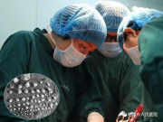 Sức khỏe - Người phụ nữ có 86 khối u xơ bám kín tử cung, BS nhắc lưu ý những dấu hiệu này