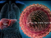 Sức khỏe - Viêm gan B: Nguyên nhân, triệu chứng và các con đường lây nhiễm